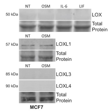 OSM, IL-6, and LIF for LOX expression.jpg